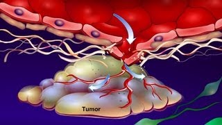 Introduction to Cancer Biology Part 4 Angiogenesis [upl. by Oirelav]