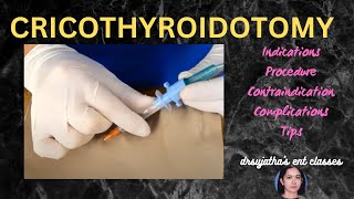 205cricothyroidotomy cricothyrotomy procedure airway emergency stridor [upl. by Aohk]