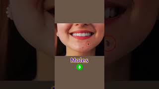 How to manage moles amp open pore Skin Care Tips  Dr Sarin [upl. by Dlabihcra]