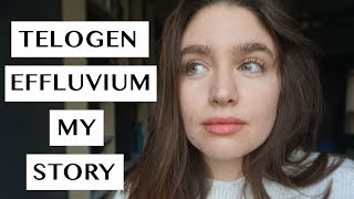 TELOGEN EFFLUVIUM  MY RECOVERY STORY  LAUREN NEWLY [upl. by Miehar42]