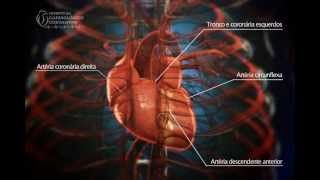 Angioplastia Coronária  Ultrassom  Hospital Cardiológico Costantini [upl. by Idissak82]