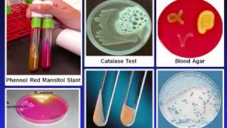 Introduction to Microbiology Culture Techniques [upl. by Valenba]