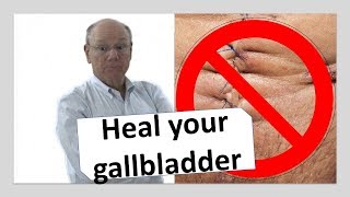 Heal your gallbladder naturally  NOW [upl. by Klos210]