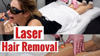 Laser Hair Removal My Review 2017 [upl. by Ahmar]