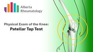 Rheumatology KNEE exam Patellar Tap Test [upl. by Arinay]