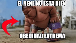 NENE CON OBESIDAD EXTREMA 🔴 REACCION 🔴 [upl. by Schofield]