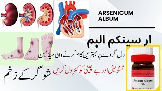 Arsenicum Album 30 200  Arsenicum uses and benefits  Rizwan Homoeopathic clinic [upl. by Bixler]