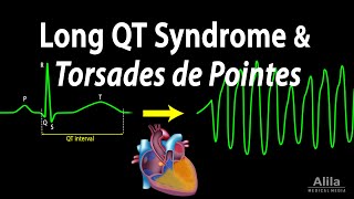 Long QT Syndrome and Torsades de Pointes Animation [upl. by Frager]