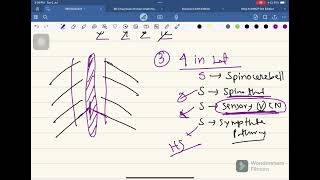 Medullary Syndrome Neurology04 FCPS Part01 Batch Whats App 01878342090 [upl. by Rosa596]