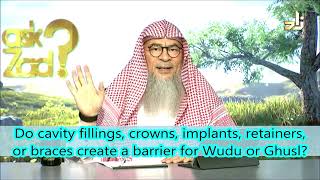 Do cavity fillings crowns implants retainers or braces create a barrier for Wudu or Ghusl [upl. by Bj474]