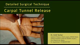 Carpal tunnel release Detailed surgical technique I Carpal tunnel syndrome I Avijit Plastic Surgery [upl. by Onurb]