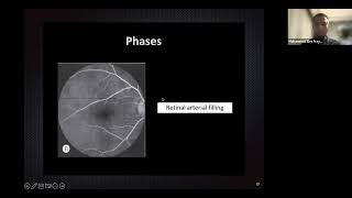 Retinal Vascularization amp FFA Mohammad Eko Prayogo [upl. by Aneek]