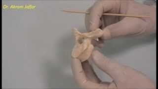 Osteology of the thoracic cage Thoracic vertebrae [upl. by Enelie]