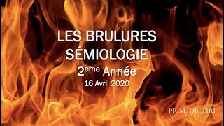 Semiologie Des Brules  Les Brulures FMPC [upl. by Rina]