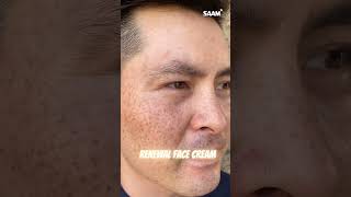 Top Dark Spot Creams You Cant Ignore darkspots darkspotsolution darkspotremover darkspotsonface [upl. by Hadeehsar]