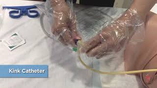 Care of Urinary Catheter  Change of Urine Bag [upl. by Grantley734]