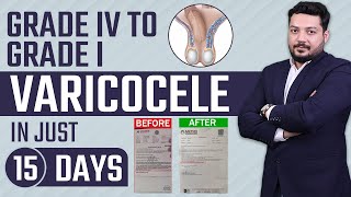 Grade 4 Varicocele Treatment  Varicocele Natural Treatment  Dr Health [upl. by Gault]