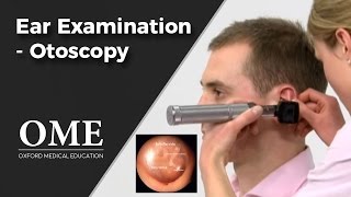 Otoscopy Ear Examination  ENT [upl. by Ashby]