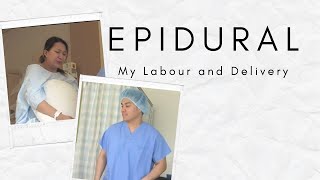 My Epidural and Delivery [upl. by Firooc]