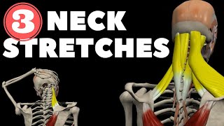 Neck Stretches for Instant pain relief [upl. by Enyaht]