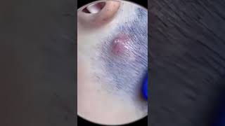 Skin Recovery respect ytshorts [upl. by Omar]