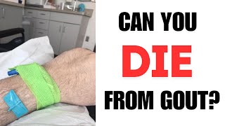 Can You Die From Tophi Gout [upl. by Twedy]