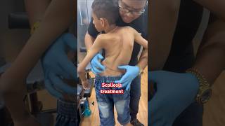 chiropractor Scoliosistreatment rkm drrajneeshkant [upl. by Trinette]