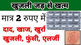 cetirizine tablet  cetirizine tablet uses in hindi  खुजली की गोली [upl. by Vada]