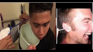 EPIC EAR WAX REMOVAL  Elephant Ear Washer Bottle System by Doctor Easy [upl. by Dorella]