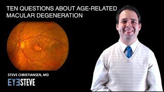 Ten Common Questions About AgeRelated Macular Degeneration [upl. by Verras]