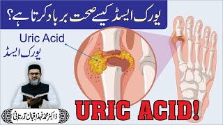 Uric Acid COMPLETE TREATMENT  Dr Fahad Artani Roshniwala [upl. by Barclay]