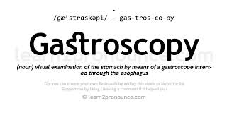 Pronunciation of Gastroscopy  Definition of Gastroscopy [upl. by Laird919]