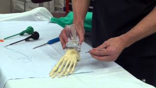 Dr Moore Explains Ankle Ligament Repair and Reinforcement Using the Arthrex Internal Brace [upl. by Amada605]