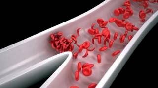 Difference Between Sickle Cell Disease and Sickle Cell Anemia [upl. by Lleryt]