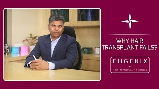 Why Hair Transplant Fails EugenixHairSciencesofficial Explained By Dr Pradeep Sethi [upl. by Trina774]