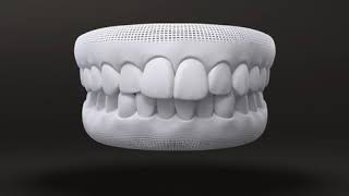 Aparelhos Ortodônticos Invisalign Tratamento para Dentes Apinhados [upl. by Pass]