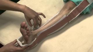 Skin traction video lecture CMU [upl. by Einaeg]