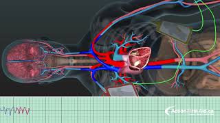 AED in Action  A 3D Look Inside the Body [upl. by Ahter]