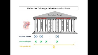 Säulen der Onkologie beim Prostatakarzinom  Strahlentherapie Prof Hilke Vorwerk [upl. by Ahsemal695]