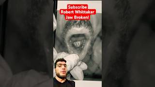 Robert Whittaker Jaw Injury Explained ufc shorts [upl. by Ymar]