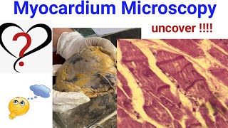 MYOCARDIUM WHAT IS THIS [upl. by Ailido]