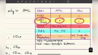 Acute leukemia AML and ALL [upl. by Jarlen]