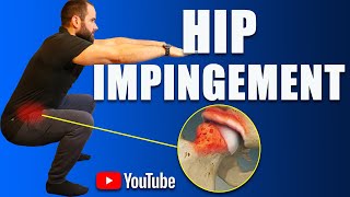 Hip Impingement Pain FAI Best Exercises Rehab amp Strengthening How to Avoid Surgery [upl. by Alair]