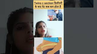 Twins c section delivery ke baad pet kitne dino me kam hota hai twins c section delivery ke baad pet [upl. by Aerdnak]