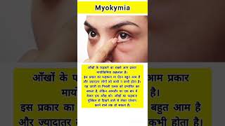 Whats myokymia healthfacts health medical medicalfacts healthcare medicaleducation shorts [upl. by Troyes]