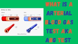 What is a arterial blood gas test AKA ABG TEST [upl. by Isa]