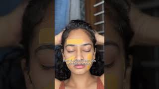 Get rid of acne overnight🤯 Band aid hack for acne  Does it work acnetreatment acne skincare [upl. by Dickerson]