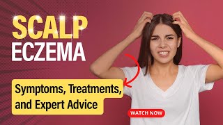 A Comprehensive Guide to Managing Scalp Eczema  Types Medication Application and Lifestyle Tips [upl. by Jeanine345]