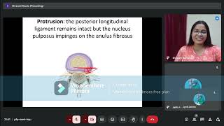 Prolapsed Intervertebral Disc Anatomy of IV Disc Part4 [upl. by Zoeller]