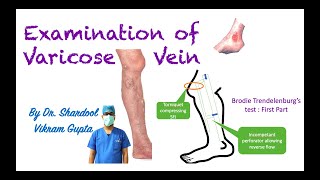 Examination of Varicose Vein for MBBS MS Surgery medical students [upl. by Imer]